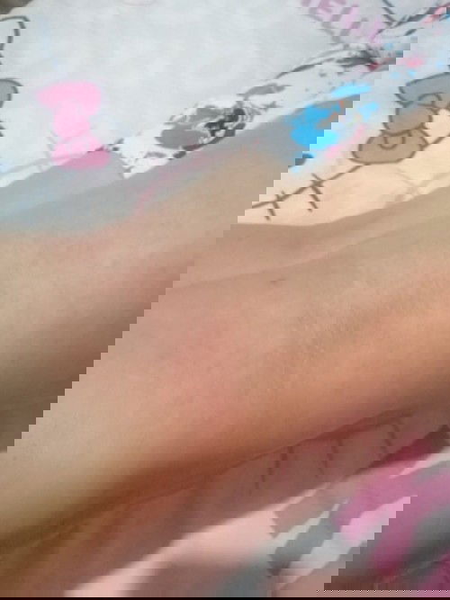 Hai mga momshie. naka try ba kayo ng ganito? rashes sa likod ng tuhod. sobrang kati kasi. 1st tri po