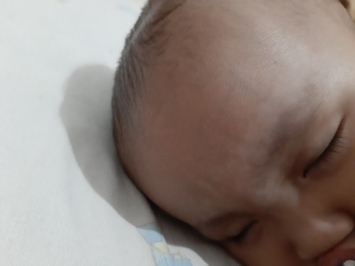 Bintik putih seperti panu