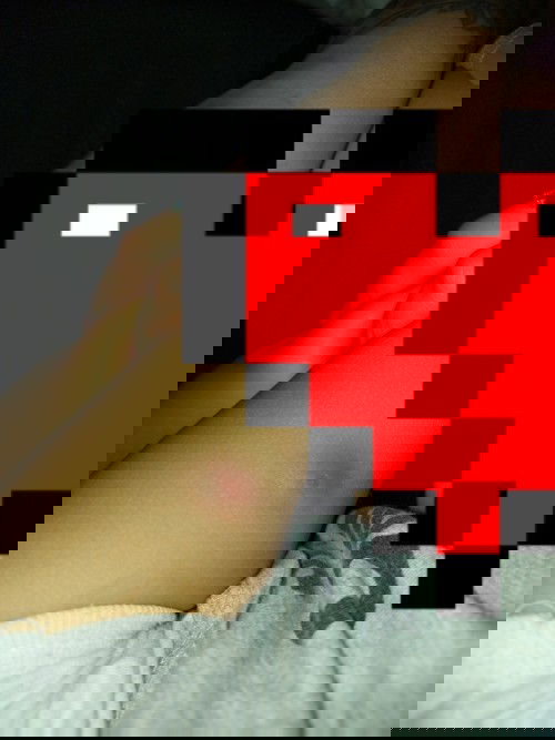 Hi po. Sino po naka try nito? Huhu sa legs po nang bb ko to. Huhu