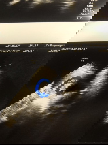 สอบถามแม่ๆว่าลูกสาวชัวร์มั้ยคะ