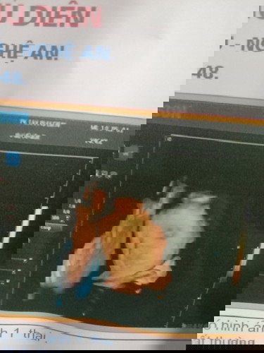 Mon cho e hỏi e dk 24w 3ngay bé dk 8lag to hay nhỏ ak