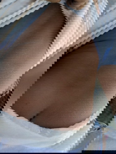 Punggung bayi 6 bulan bentol" kecil" banyak