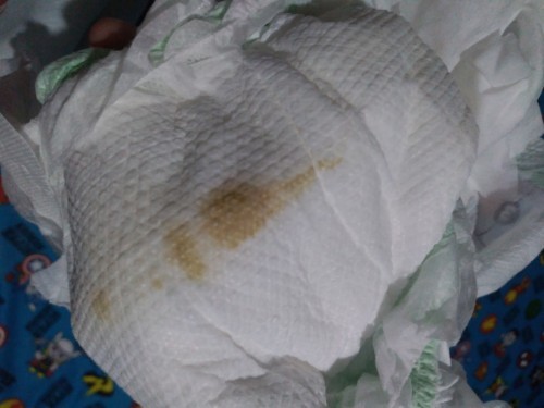 Hndi makapoops, 3 days na. 6 months and 17 days