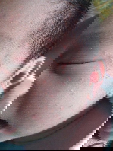 Rashes or what?