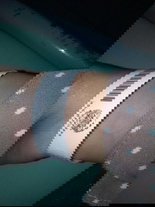 Janin tidak berkembang,dan berakhir kuret