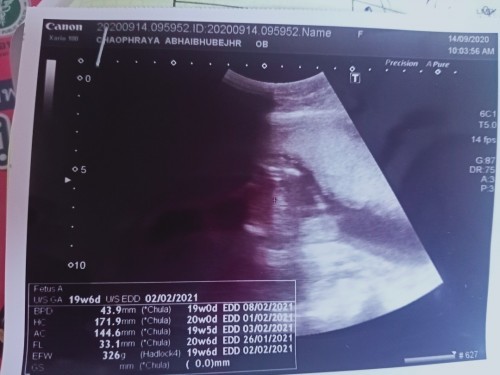 ดูไม่เป็นเรยค่ะว่าหญิงหรือชาย