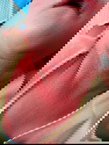 Bintik merah