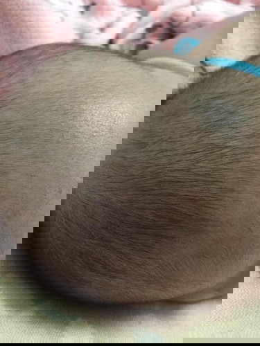 สงสัยว่าน้องจะติดเชื้อ