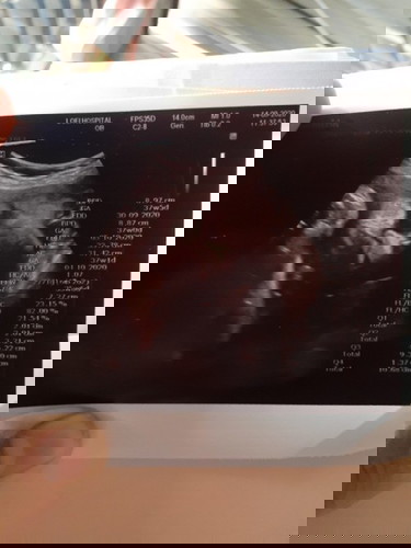 36wเต็มกลับหัวแล้ว