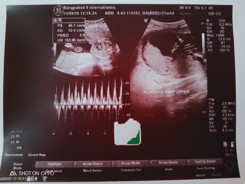 แม่ๆทันไหนดูออกไหมค่ะว่าเพศอะไร