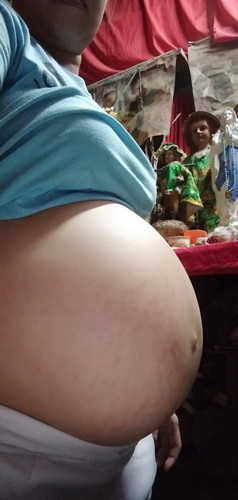 37wks and 1day.