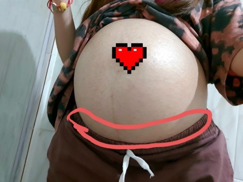 เจ็บท้องจี๊ดๆ จะเป็นอะไรมั้ยคะ