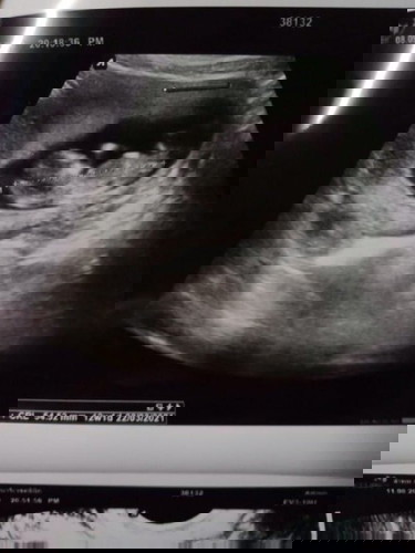 12w+6 จร้าา