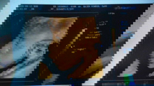 USG tapi dr nya kurang komunikatif