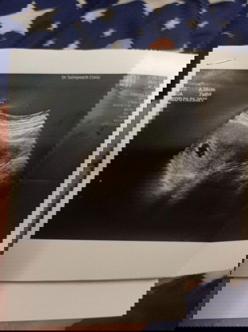 กี่วิคถึงชาวเจอตัวถุงตั้งครรภ์เเละอ่อน