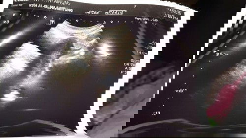 Kata Bidan dan Dokter Berbeda