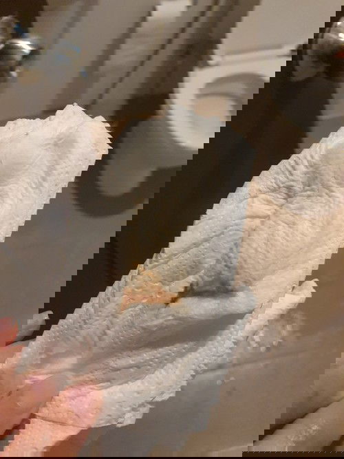 ตั้งครรภ์31 สัปดาห์ มีตกขาวแบบนี้คืออะไรคะ