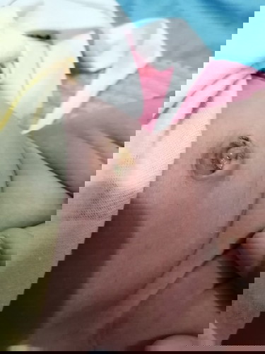 Umbilical Cord