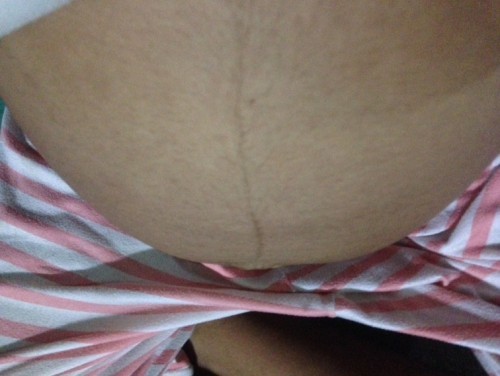 พุงแบบนี้ ผ. ช ค่ะ