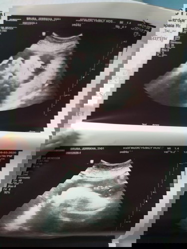 Tama lang po ba laki ni baby?