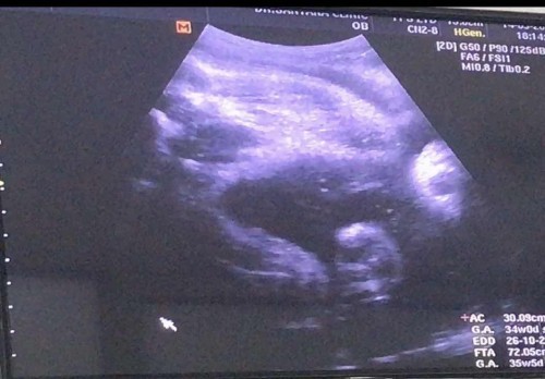 ขอสอบถามค่า