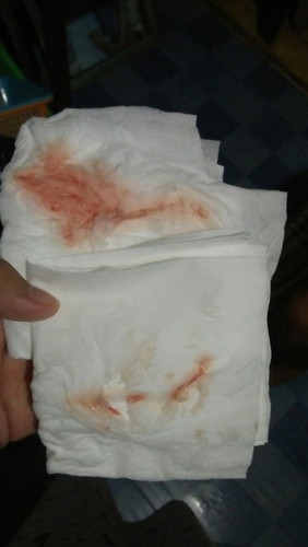 Tanda melahirkan kah?