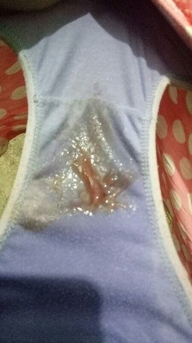 Mucus plug na bo ba ito??