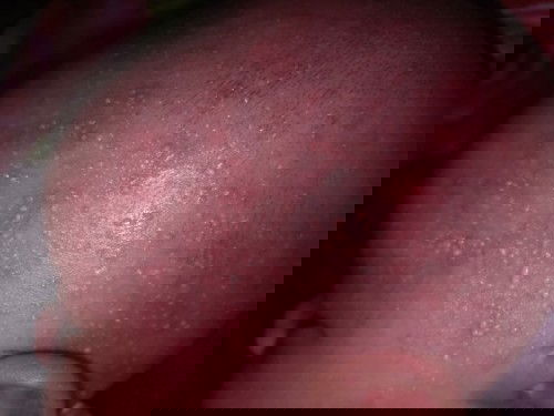 Kepala bayi beruntus