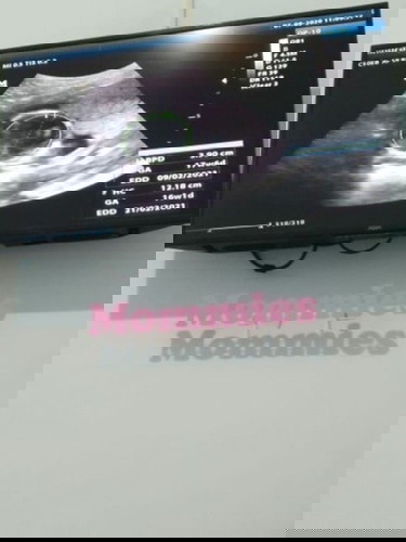 foto kehamilan 17 week ( cek kontrol )