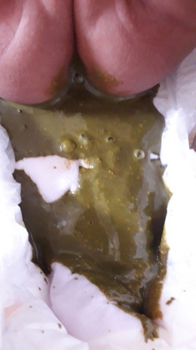 Najis baby saya mcm ni lpas tukar susu .sebelum ni baby minum s26 tapi 2 ke 3 hari baru membuang