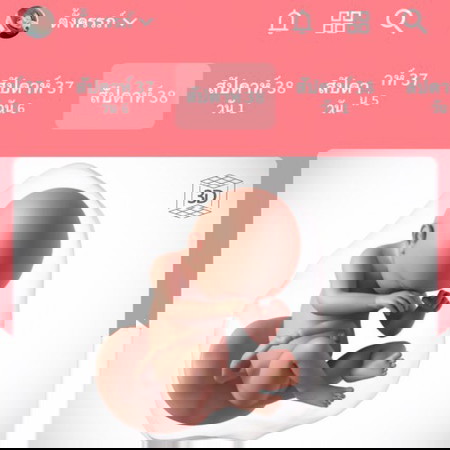 ประสบการณ์ผ่าคลอด