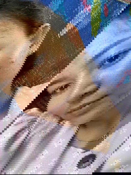 ใครพอมีครีมหรือเซรั่มทาไหมคะ