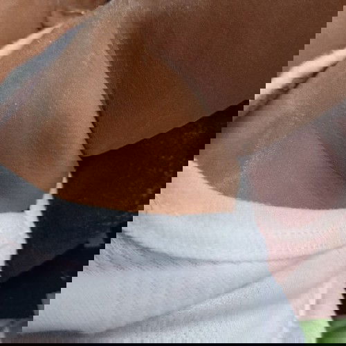 Benjolan di ketiak bayi