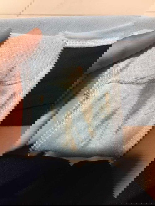 37+4วิคมีแบบนี่ควรไปหาหมอมั้ยค่ะ