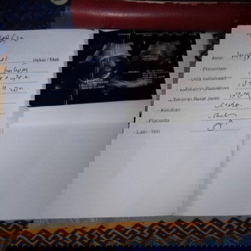 posisi kepala bayi masih d atas