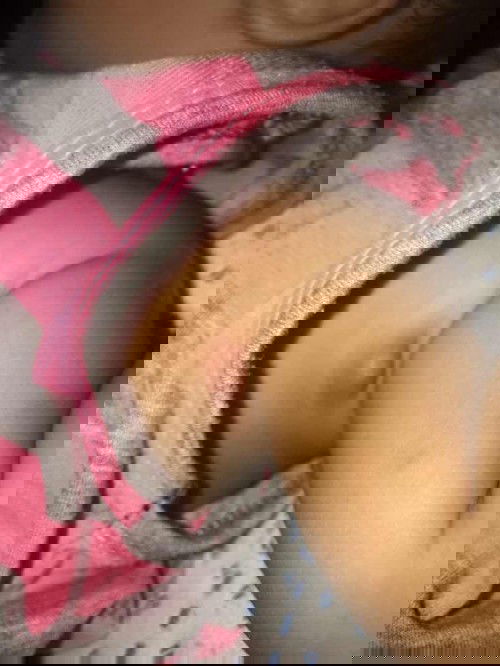 Bé bị nổi cục như này bên trái có phải bị nổi hạch ko ạ. Làm sao để nó xẹp xuống ạ???