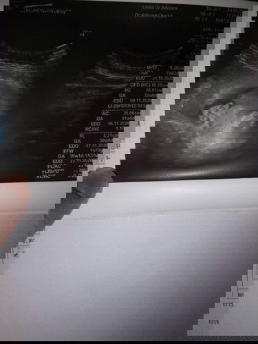 กำหนดคลอดเดือน13 พย. ค่ะ