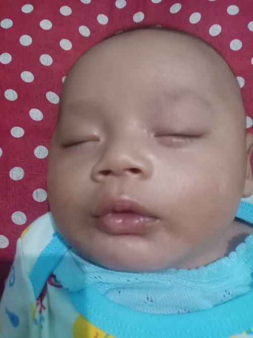 Cream untuk bayi