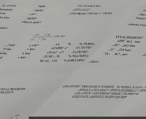 result: Advance assesment