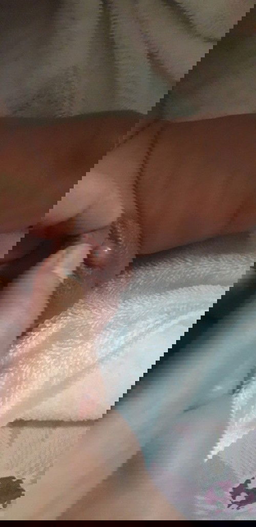 benjolan di bawah penis