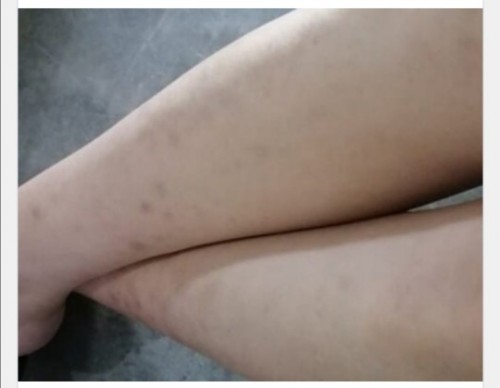 My scars, my insecurities