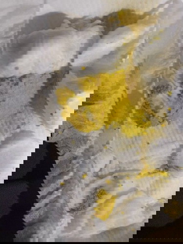 อึลูกกินนมแม่เป็นแบบนี้ปกติมั้ย