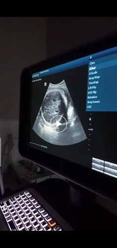 hy nx tnye , kalau kndgn dh 8 bln bole bkak bku pink x? agak² kne mrah tak?? sbb xde sjil nikahhh ..