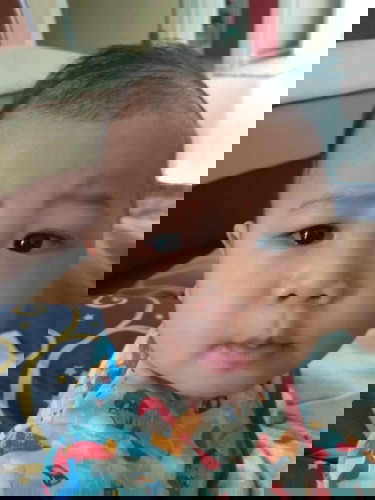 Mata merah sebelah kanan