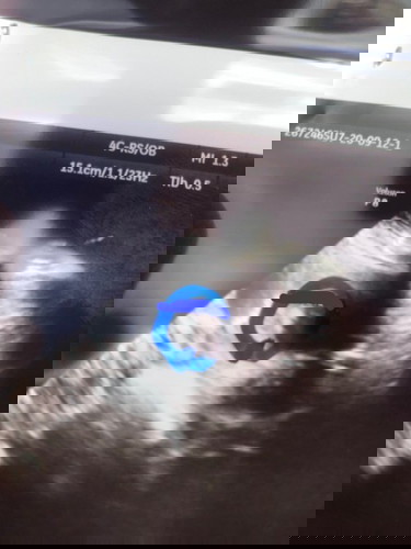 รบกวนช่วยดูให้ทีค่ะแม่ๆว่าเพศอะไร