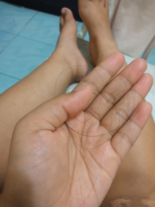 rambut rontok