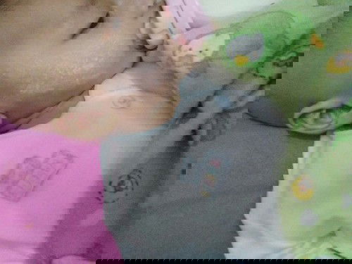 Pipi merah merah dan kering