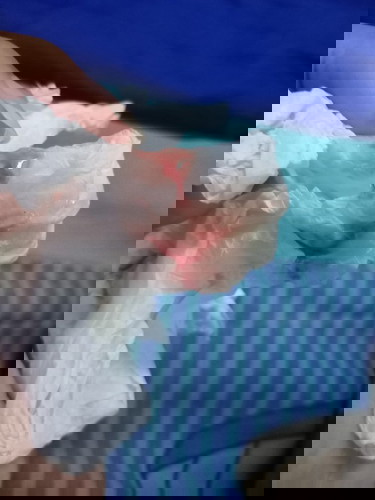 38+5w มีมา2วัน วันเเรกมีเเต่ตอนตื่นนอนระหว่างวันไม่มีค่ะ