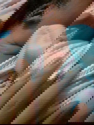 คอมีรอยแดง