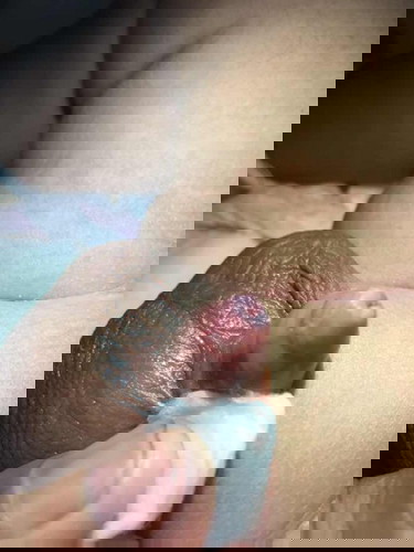 Normal kang puba pototoy ni lo?🥺